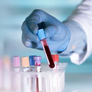 Sample Handling